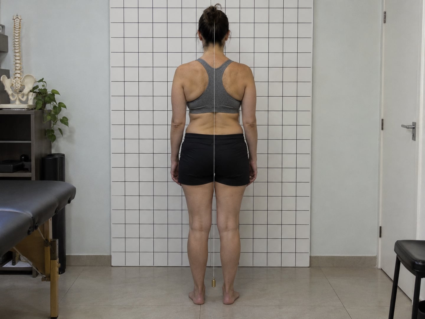 Postura e Escoliose — Antes